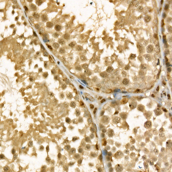 Thymidylate Synthase Antibody in Immunohistochemistry (Paraffin) (IHC (P))