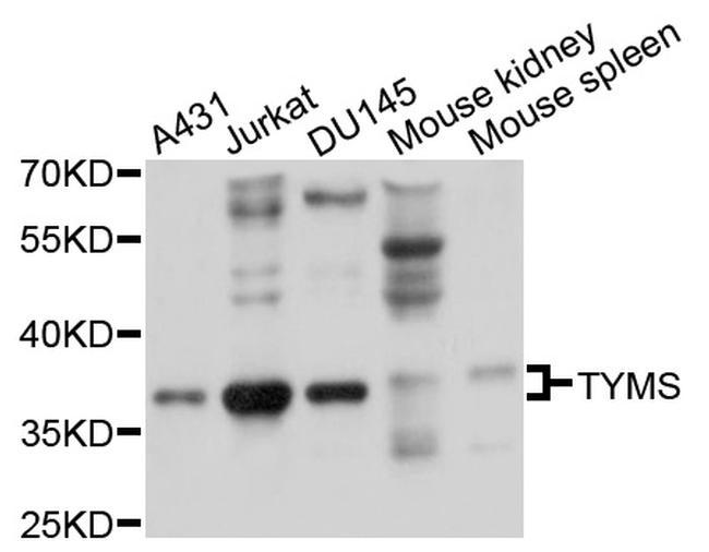 Thymidylate Synthase Antibody in Western Blot (WB)