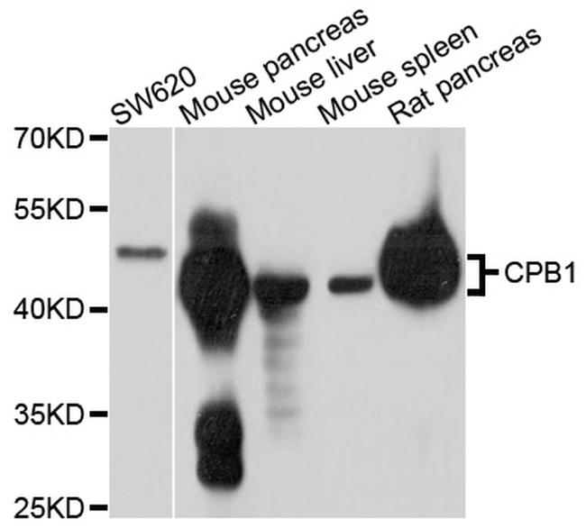 Carboxypeptidase B1 Antibody in Western Blot (WB)