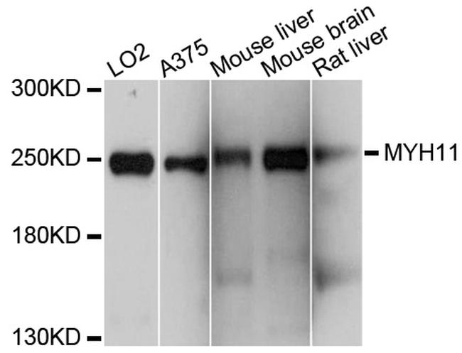 MYH11 Antibody in Western Blot (WB)