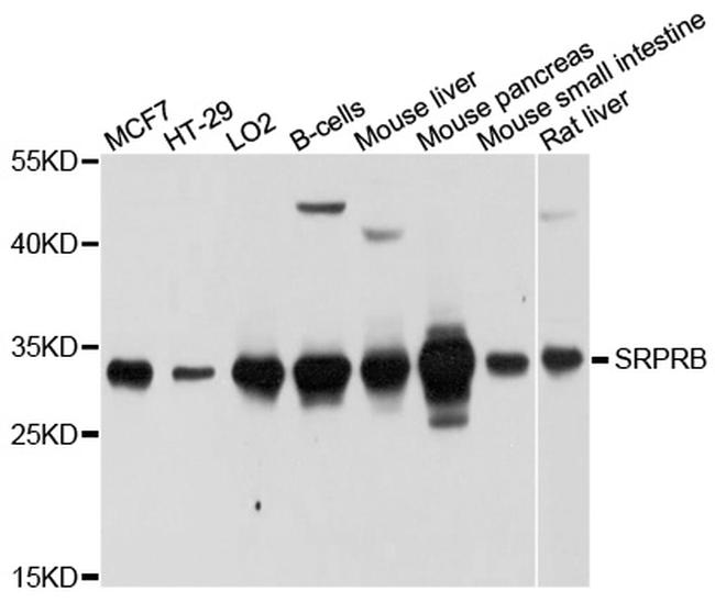 SRPRB Antibody in Western Blot (WB)