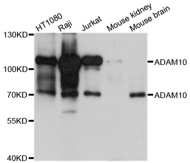 ADAM10 Antibody in Western Blot (WB)