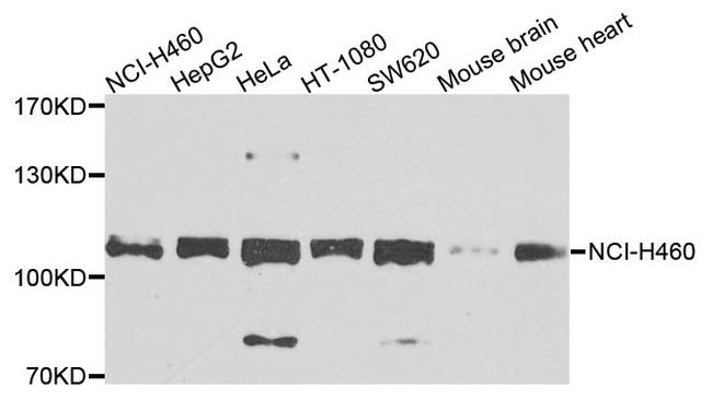 EphB2 Antibody in Western Blot (WB)