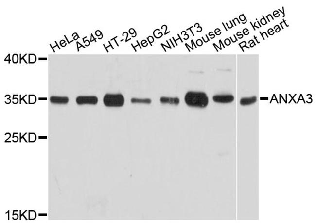 Annexin A3 Antibody in Western Blot (WB)