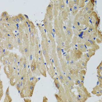 CKMT2 Antibody in Immunohistochemistry (Paraffin) (IHC (P))