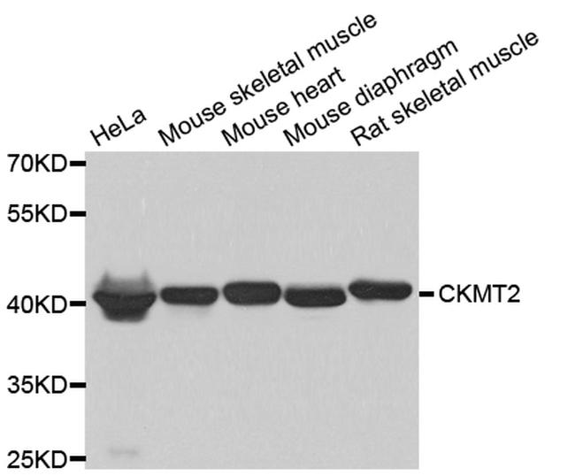 CKMT2 Antibody in Western Blot (WB)