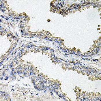 Aconitase 1 Antibody in Immunohistochemistry (Paraffin) (IHC (P))