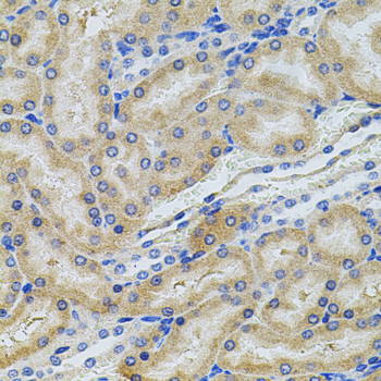 PCSK9 Antibody in Immunohistochemistry (Paraffin) (IHC (P))