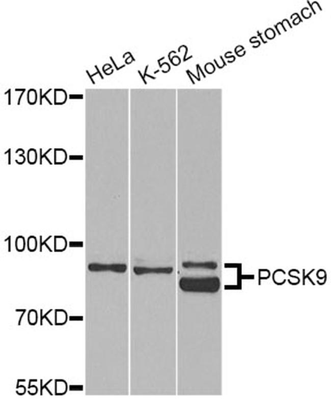 PCSK9 Antibody in Western Blot (WB)