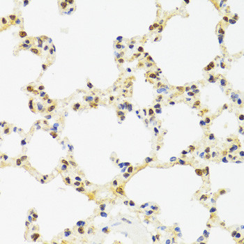 SUZ12 Antibody in Immunohistochemistry (Paraffin) (IHC (P))