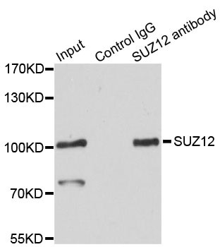 SUZ12 Antibody in Immunoprecipitation (IP)