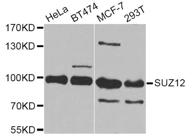 SUZ12 Antibody in Western Blot (WB)