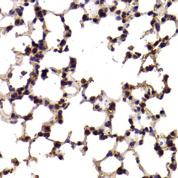 SF1 Antibody in Immunohistochemistry (Paraffin) (IHC (P))