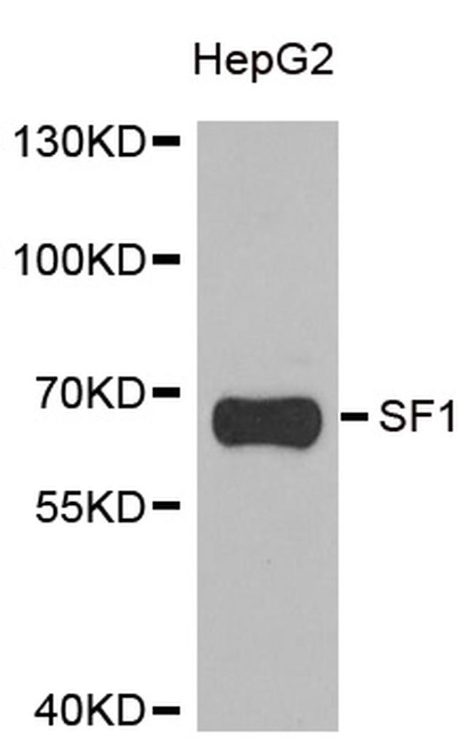 SF1 Antibody in Western Blot (WB)