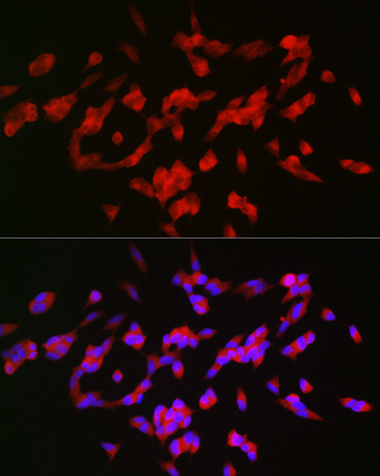 GAP43 Antibody in Immunocytochemistry (ICC/IF)