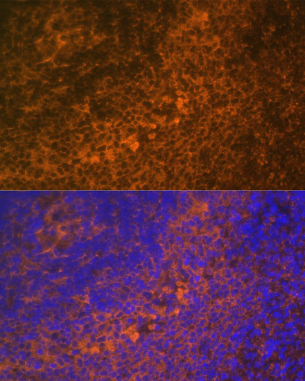 DR4 Antibody in Immunocytochemistry (ICC/IF)