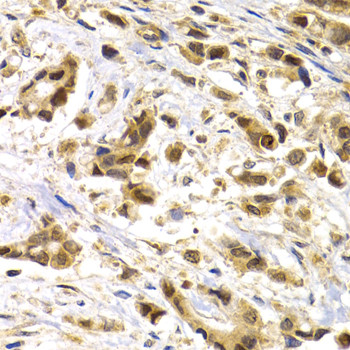 MAGE1 Antibody in Immunohistochemistry (Paraffin) (IHC (P))