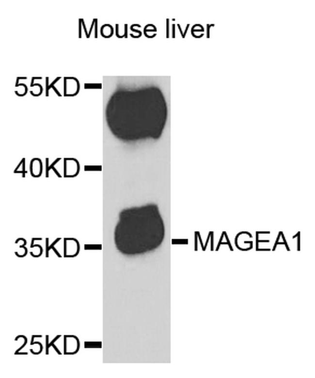 MAGE1 Antibody in Western Blot (WB)