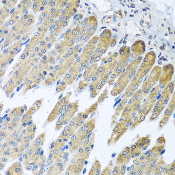 NDUFB10 Antibody in Immunohistochemistry (Paraffin) (IHC (P))