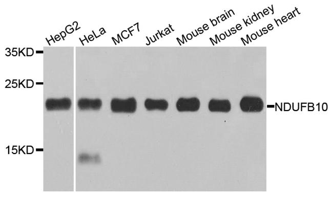 NDUFB10 Antibody in Western Blot (WB)