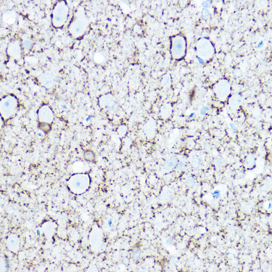 GAD67 Antibody in Immunohistochemistry (Paraffin) (IHC (P))