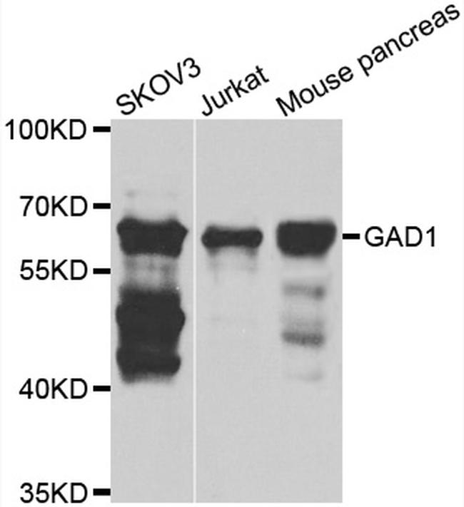 GAD67 Antibody in Western Blot (WB)