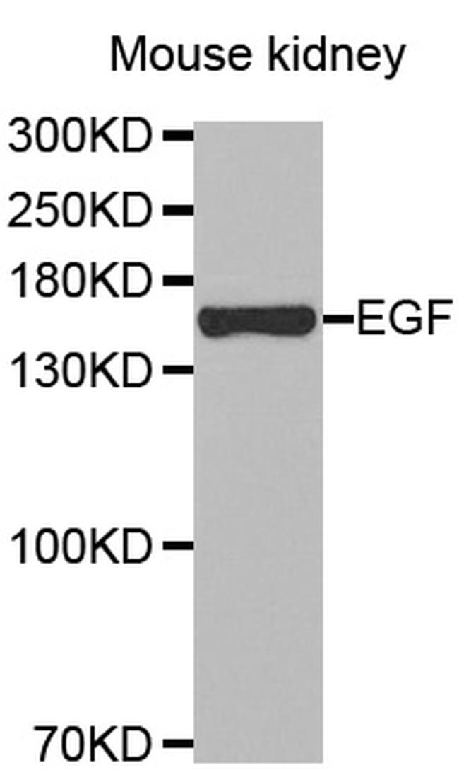 EGF Antibody in Western Blot (WB)