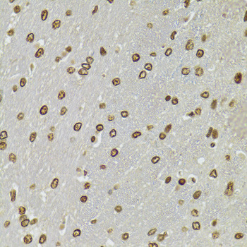 CDX2 Antibody in Immunohistochemistry (Paraffin) (IHC (P))