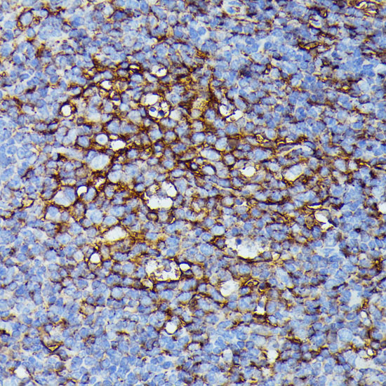 HLA-B Antibody in Immunohistochemistry (Paraffin) (IHC (P))