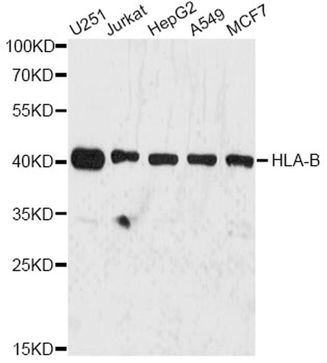 HLA-B Antibody in Western Blot (WB)