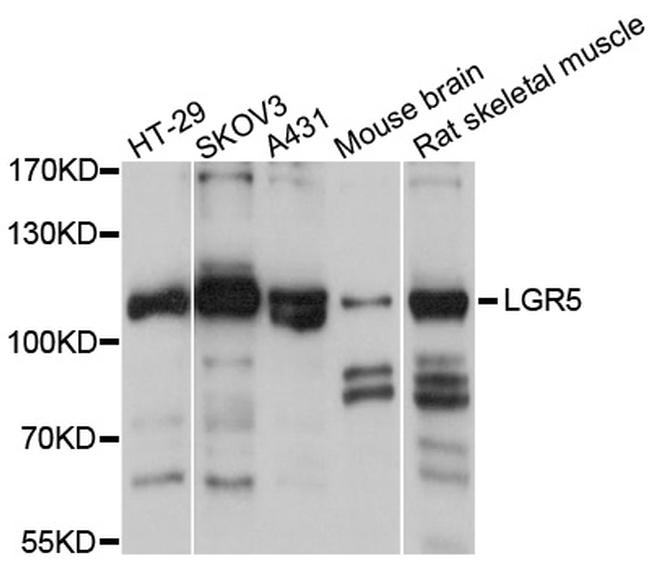 LGR5 Antibody in Western Blot (WB)