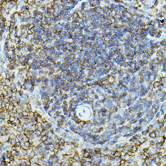 CD79a Antibody in Immunohistochemistry (Paraffin) (IHC (P))