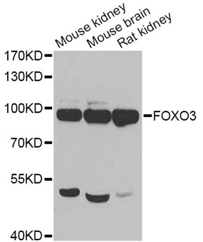 CD79a Antibody in Western Blot (WB)