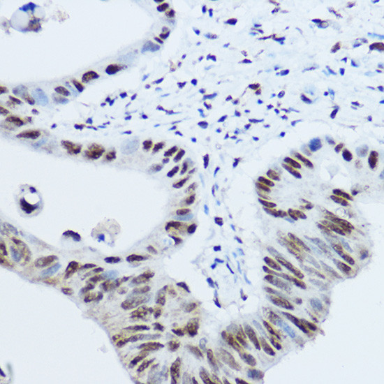 hnRNP H1 Antibody in Immunohistochemistry (Paraffin) (IHC (P))