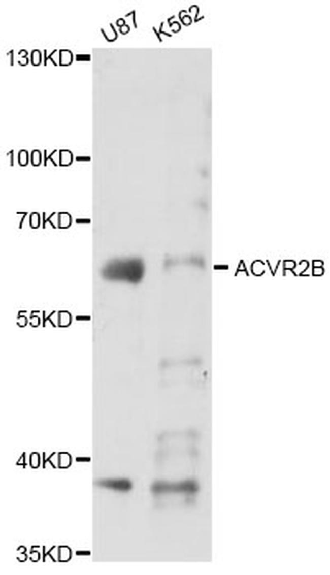 ACVR2B Antibody in Western Blot (WB)