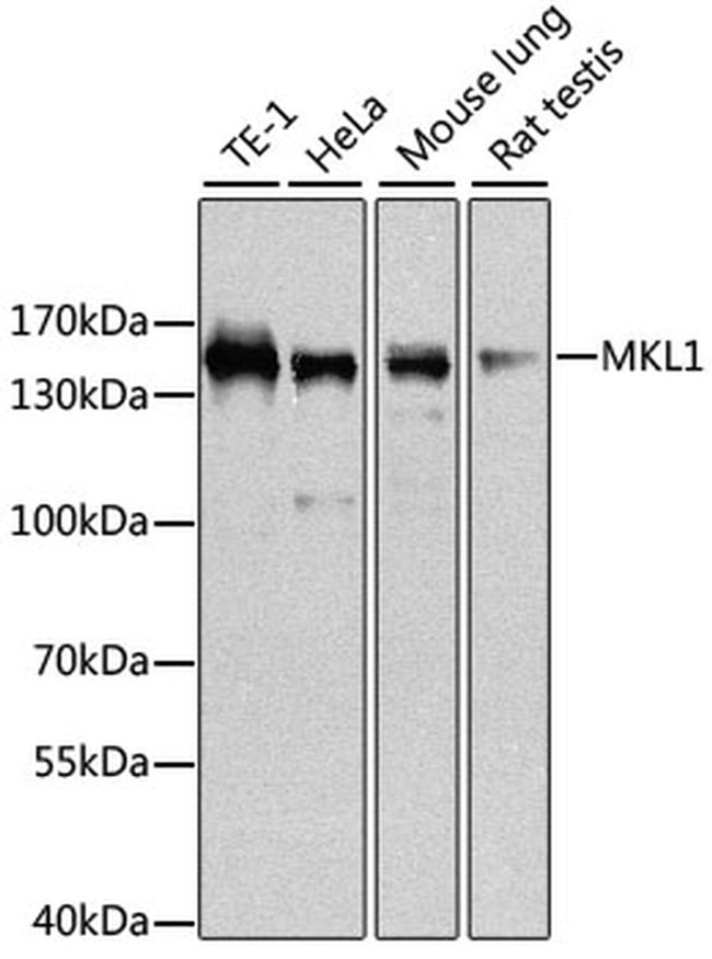 MKL1 Antibody in Western Blot (WB)