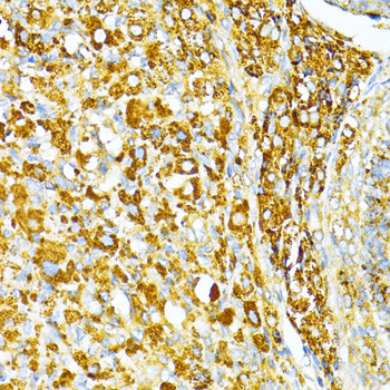 VAMP1 Antibody in Immunohistochemistry (Paraffin) (IHC (P))