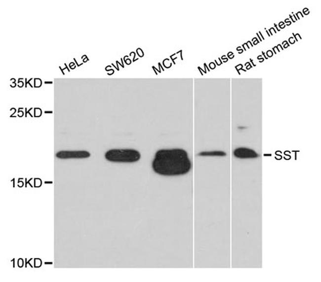 Somatostatin Antibody in Western Blot (WB)