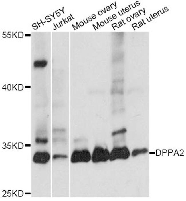 DPPA2 Antibody in Western Blot (WB)