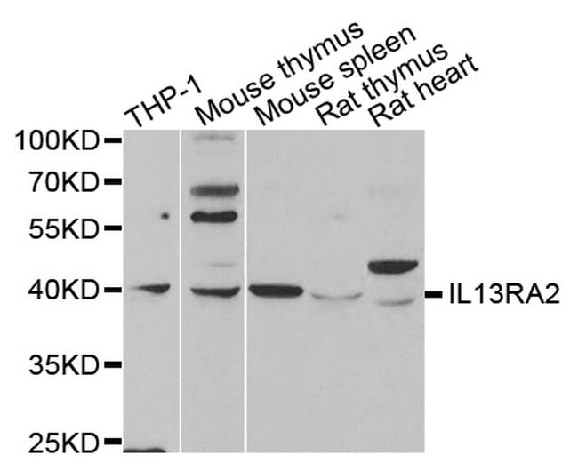 IL13RA2 Antibody in Western Blot (WB)