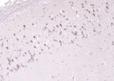 ADSL Antibody in Immunohistochemistry (Paraffin) (IHC (P))