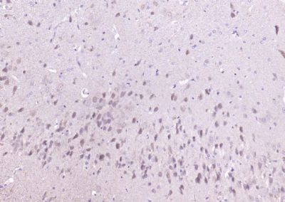 ADSL Antibody in Immunohistochemistry (Paraffin) (IHC (P))