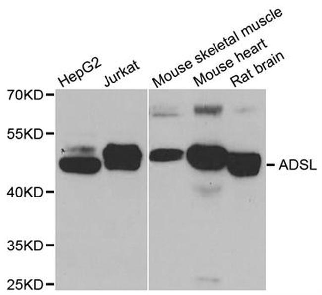 ADSL Antibody in Western Blot (WB)