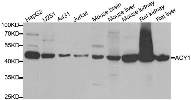 Aminoacylase Antibody in Western Blot (WB)