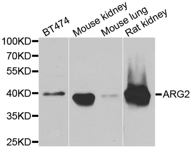 Arginase 2 Antibody in Western Blot (WB)