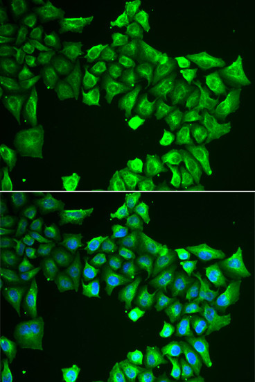 ASL Antibody in Immunocytochemistry (ICC/IF)