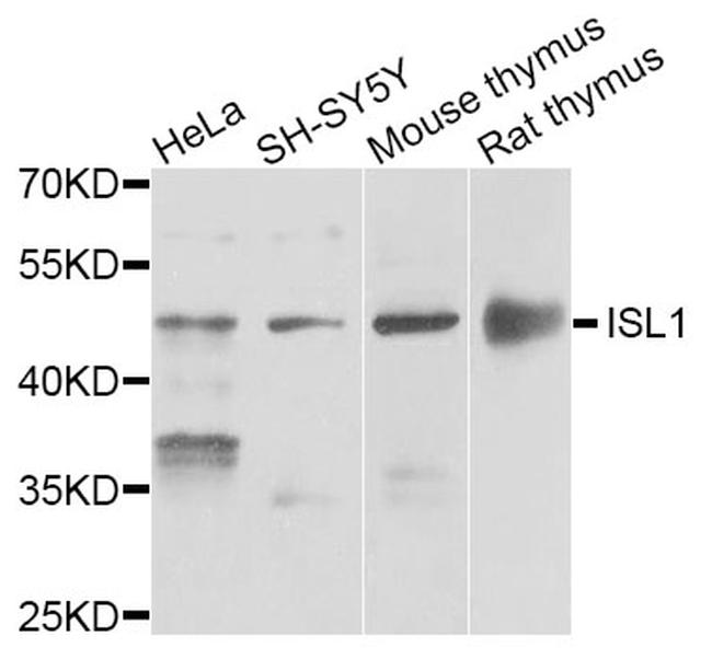 ISL1 Antibody in Western Blot (WB)