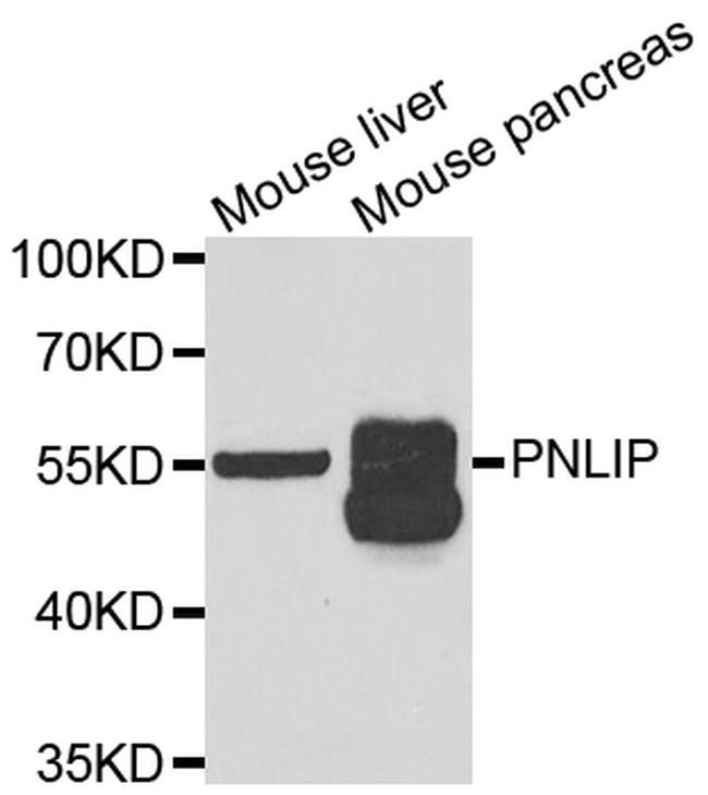 PNLIP Antibody in Western Blot (WB)