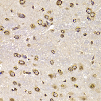 Lamin B2 Antibody in Immunohistochemistry (Paraffin) (IHC (P))