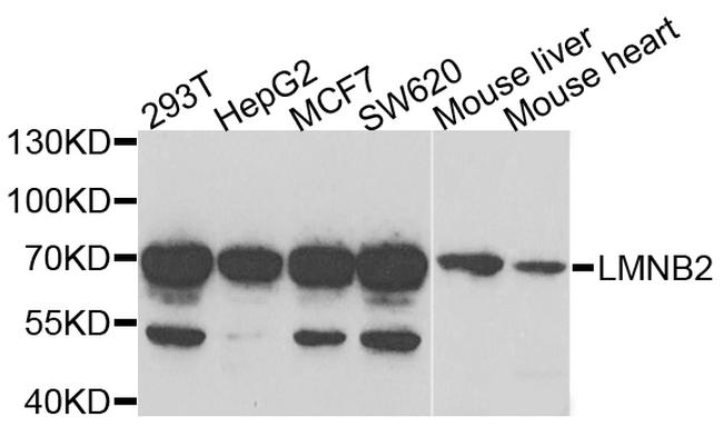 Lamin B2 Antibody in Western Blot (WB)